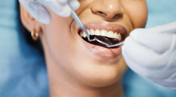 Best Emergency Treatment for Dental Infections or Abscesses in Cottageville, SC