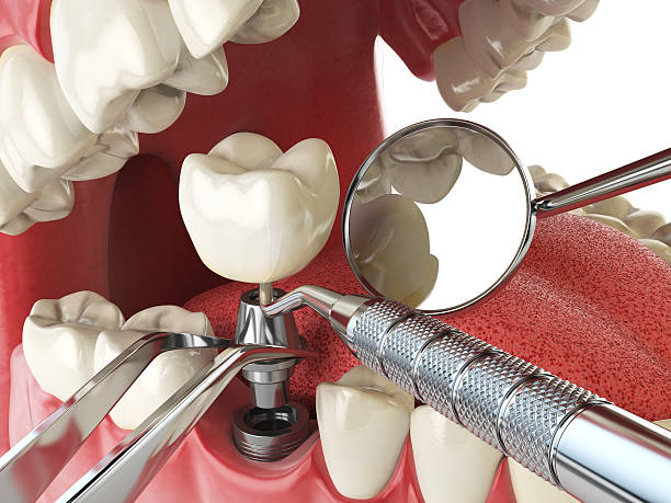 Best Urgent Care for Lost Fillings or Crowns in Cottageville, SC