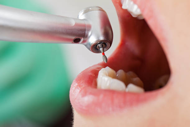 Best Cosmetic Emergency Dentistry in Cottageville, SC